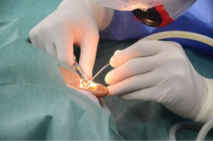 Endoscopic and Microscopic Ear Surgeries